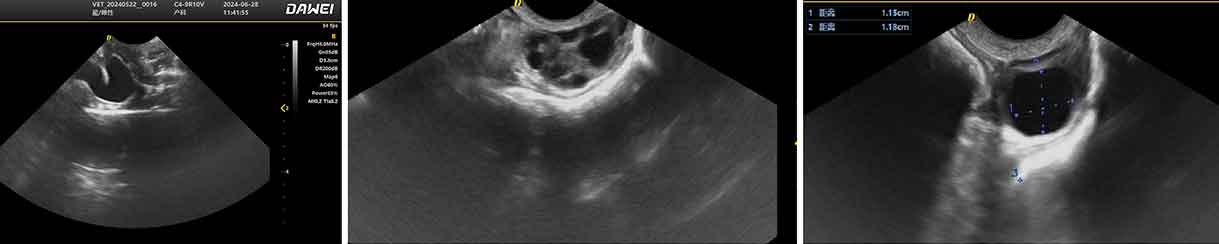 Ramassage d'ovule