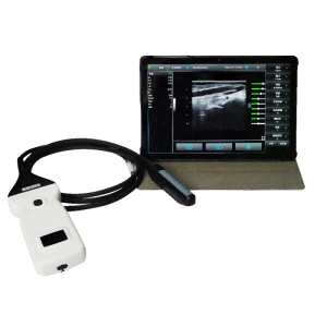 Rectal Ultrasound Probe