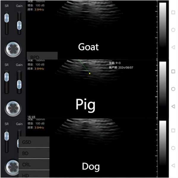 wireless ultrasound probe