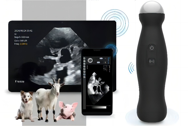 wireless ultrasound scanner